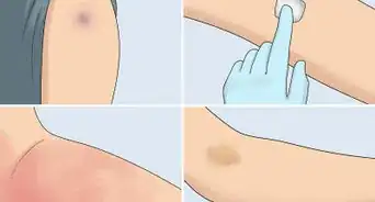 faire une injection dans une veine