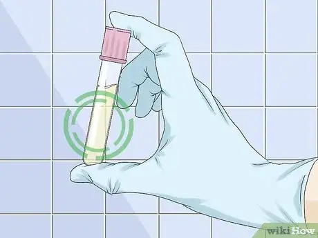 Image intitulée Use a Urine Dipstick Test Step 11