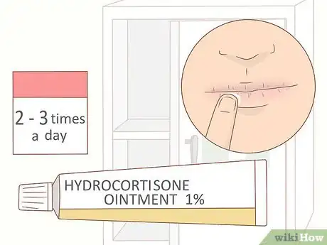 Image intitulée Take Care of Your Skin While on Accutane Step 16