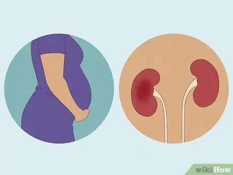 Image intitulée Reduce ESR Step 9