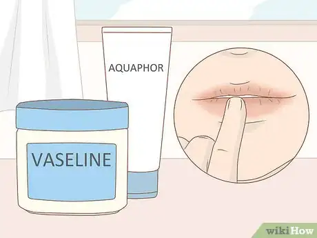 Image intitulée Take Care of Your Skin While on Accutane Step 15