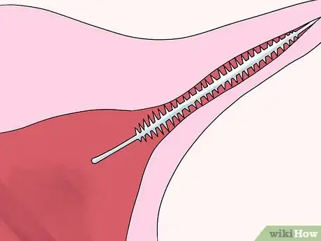 Image intitulée Not Get Pregnant Step 11