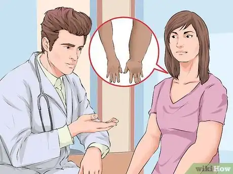 Image intitulée Prevent Lymphedema Step 1