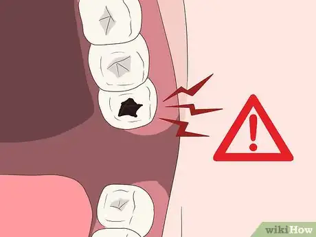 Image intitulée Cure a Toothache Step 6