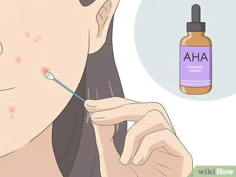 Image intitulée Have Clear Skin Naturally Step 11