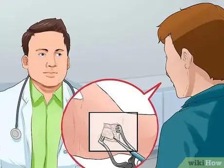 Image intitulée Sleep with Carpal Tunnel Syndrome Step 16