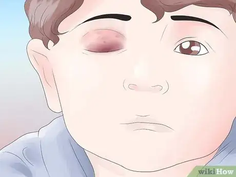 Image intitulée Know if You Have Labyrinthitis Step 10