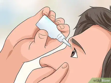 Image intitulée Remove Stuck Contact Lenses Step 16