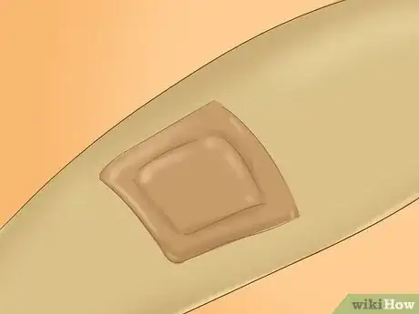 Image intitulée Recognize Molluscum (Molluscum Contagiosum) Step 8