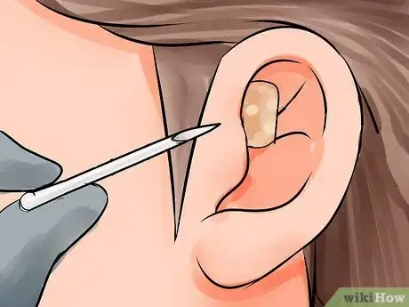 Image intitulée Pierce Your Forward Helix Step 10