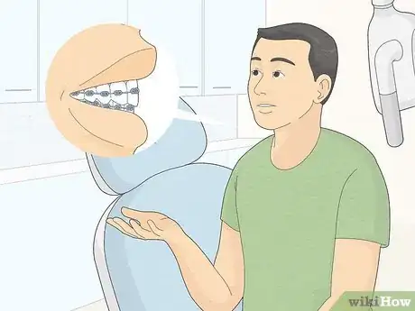 Image intitulée Fix Crooked Teeth Step 3