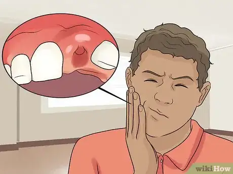 Image intitulée Deal With a Tooth Pulling Step 14
