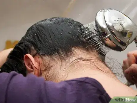 Image intitulée Treat Seborrheic Dermatitis Step 11