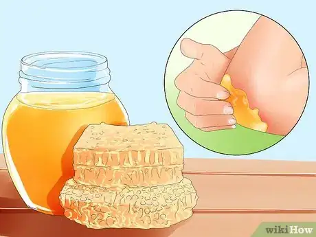Image intitulée Treat Carpet Burns Step 10