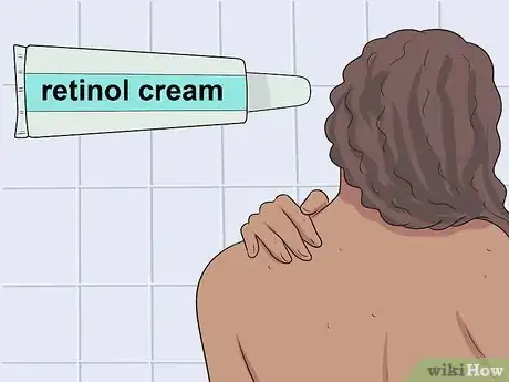 Image intitulée Get Rid of Bacne Step 14