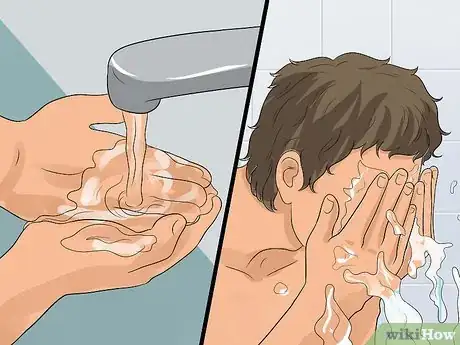 Image intitulée Decrease the Size of a Pimple Overnight Step 1