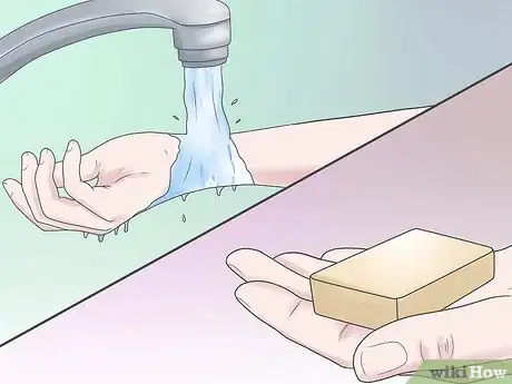Image intitulée Treat a Fire Ant Sting Step 6