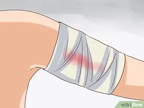 Image intitulée Treat an Adverse Reaction to a Flu Vaccine Step 8