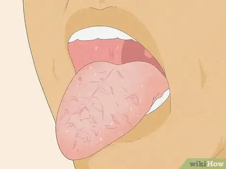 Image intitulée Fix Bad Breath on the Spot Step 17
