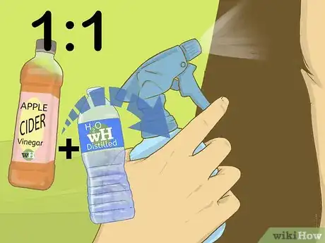 Image intitulée Prevent Dry Scalp Step 2