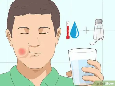 Image intitulée Cure a Toothache Step 5