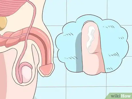 Image intitulée Recognize Chlamydia Symptoms (for Men) Step 1