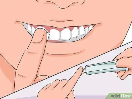 Image intitulée Cure a Toothache Step 3