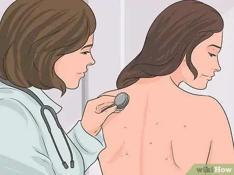 Image intitulée Get Rid of Bacne Step 16
