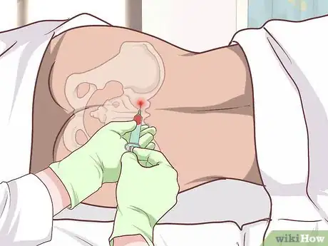Image intitulée Diagnose Fanconi Anemia Step 16