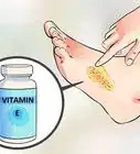 retirer ses points de suture