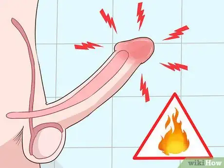 Image intitulée Recognize Chlamydia Symptoms (for Men) Step 3