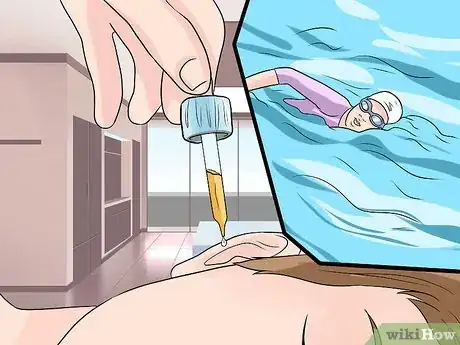 Image intitulée Treat an Outer Ear Infection Step 17