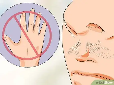 Image intitulée Treat Ingrown Nose Hairs Step 2