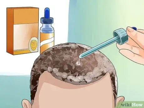 Image intitulée Hide Baldness Step 16