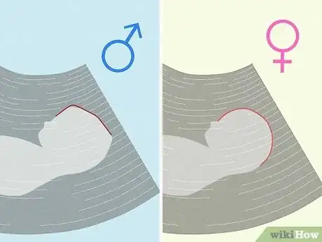 Image intitulée Tell if You're Pregnant with a Girl or Boy Step 1