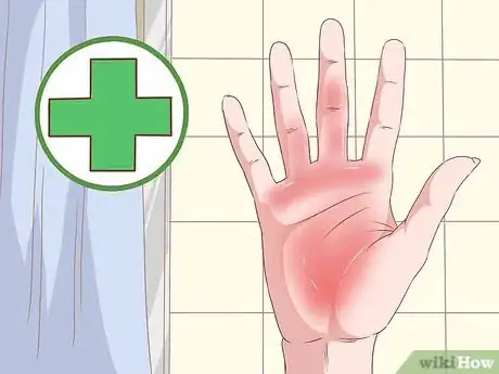 Image intitulée Deal With the Pain of a Door Being Shut on Your Finger Step 9