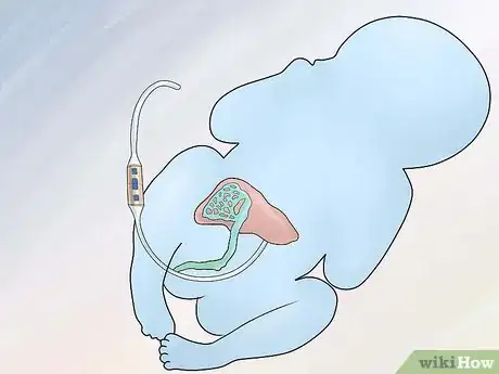 Image intitulée Increase Amniotic Fluid Step 5