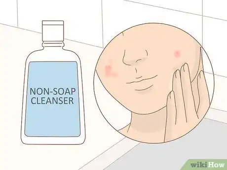 Image intitulée Take Care of Your Skin While on Accutane Step 4