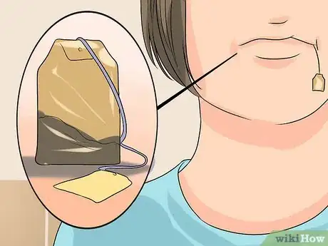 Image intitulée Pull Out a Tooth Without Pain Step 9