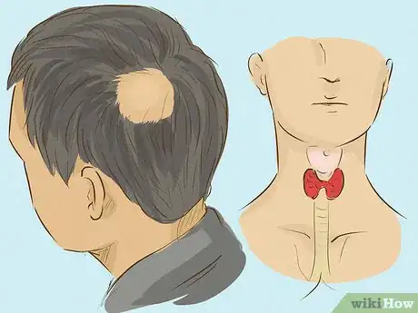 Image intitulée Tell if You're Going Bald Step 6