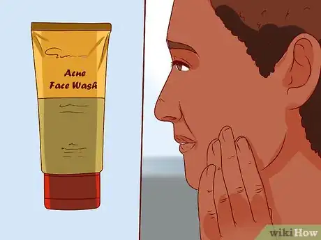 Image intitulée Get Rid of Pimples with Aloe Vera Gel Step 1