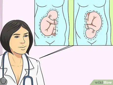 Image intitulée Hear the Fetal Heartbeat Step 4