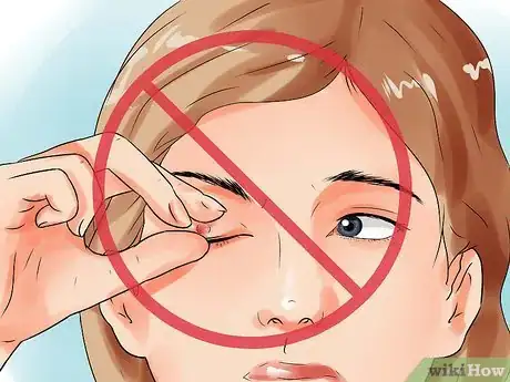 Image intitulée Get Rid of a Stye Step 3