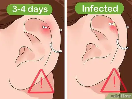 Image intitulée Clean a Cartilage Piercing Step 8