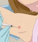 se débarrasser des boutons sous les aisselles