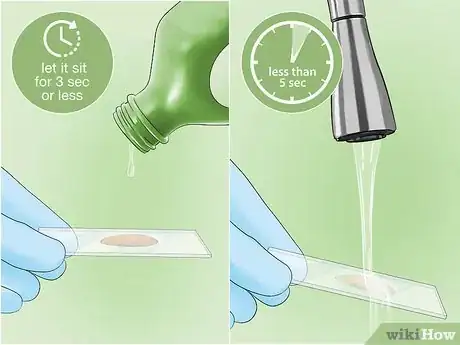 Image intitulée Identify Bacteria Step 7