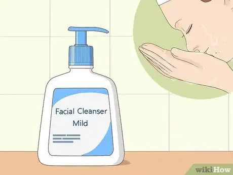 Image intitulée Treat Whiteheads Step 1