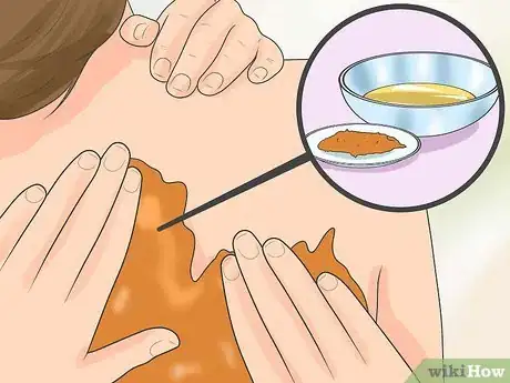 Image intitulée Naturally Stop Granuloma Annulare Step 2