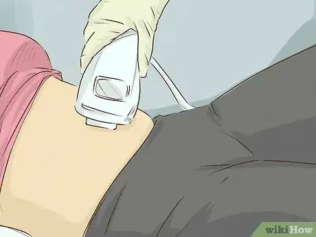 Image intitulée Get Rid of Stretch Marks Step 8