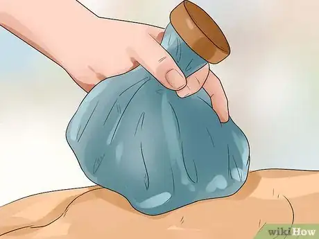 Image intitulée Treat a Sprain on a Dog Step 11